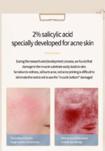 Acne Removing Salicylate Products - Image 2